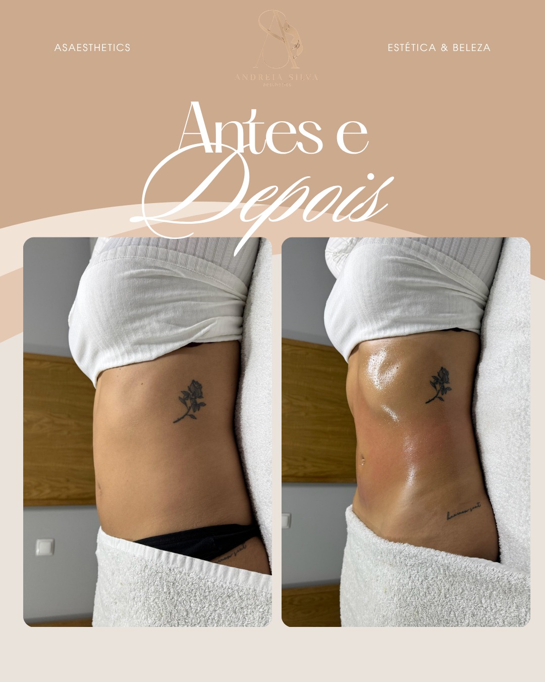 Antes e depois — contorno corporal