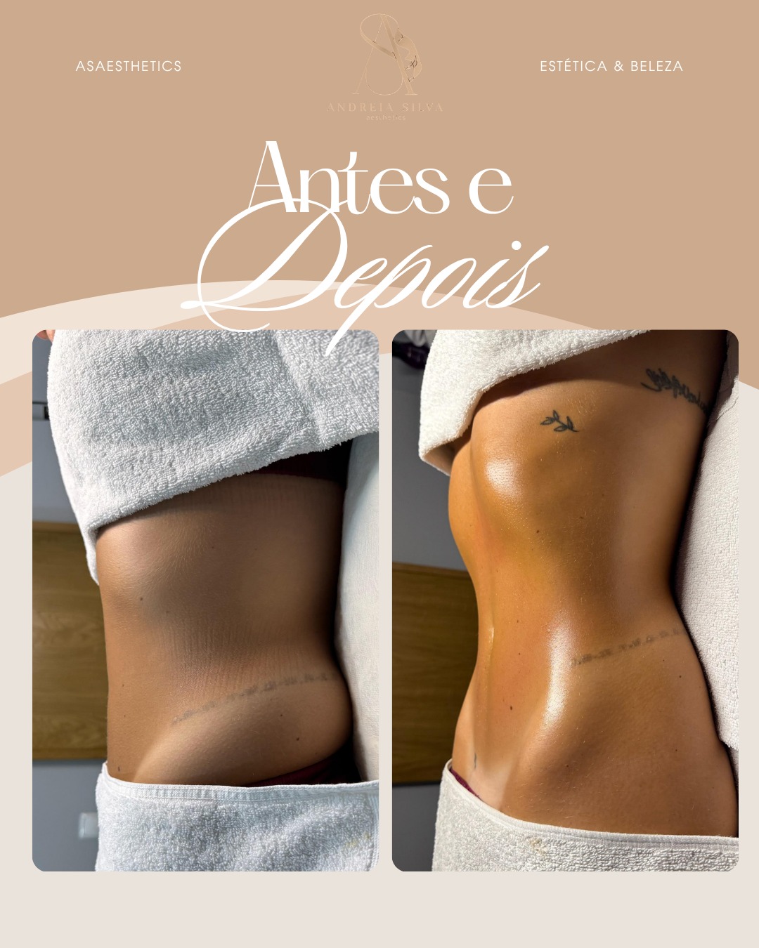 Antes e depois — abdómen lateral